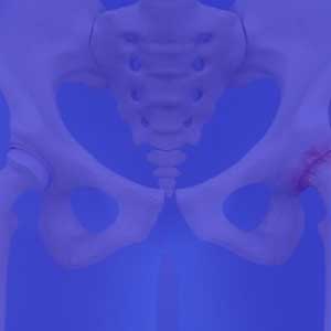 hip replacement in vizag