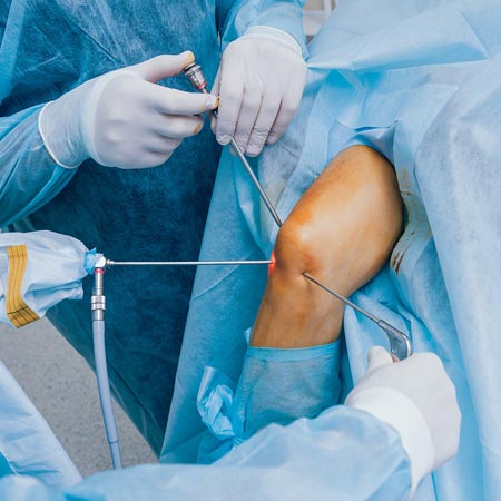 arthroscopy in vizag