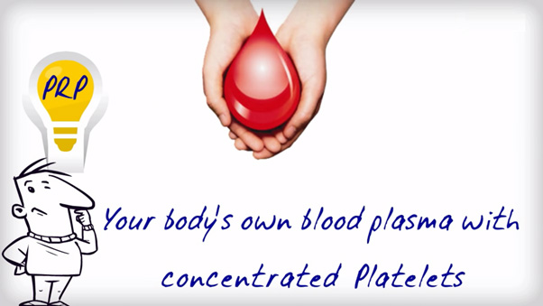 platelet rich plasma